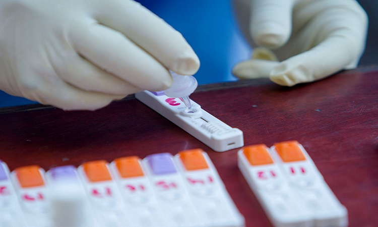 अग्रपंक्तिमा खटिने कर्मचारीले  साताको दुई पटक एन्टिजेन परीक्षण गर्नुपर्ने