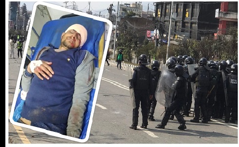 बानेश्वरमा घाईते अवस्थीको अवस्था गम्भिर, थप उपचारका लागि अन्नपूर्ण न्यूरो ल्याइदै