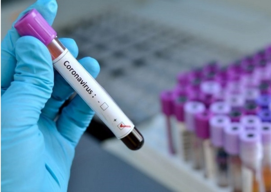 थप २१ जनामा कोरोना पुष्टि, १६ जना संक्रमण मुक्त