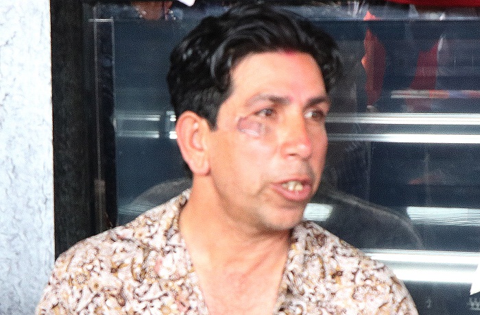 इटहरीमा एमाले नेतामाथि कुटपिट